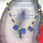 Preview: Mineralien Lapislazuli Citrin Kette